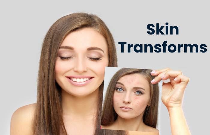 Skin Transforms