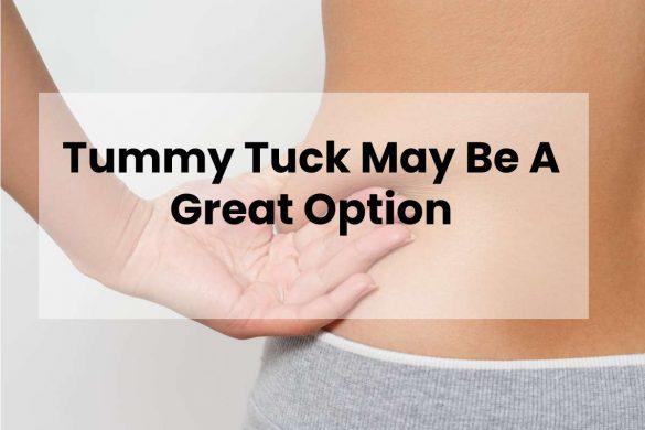 Tummy Tuck May Be A Great Option
