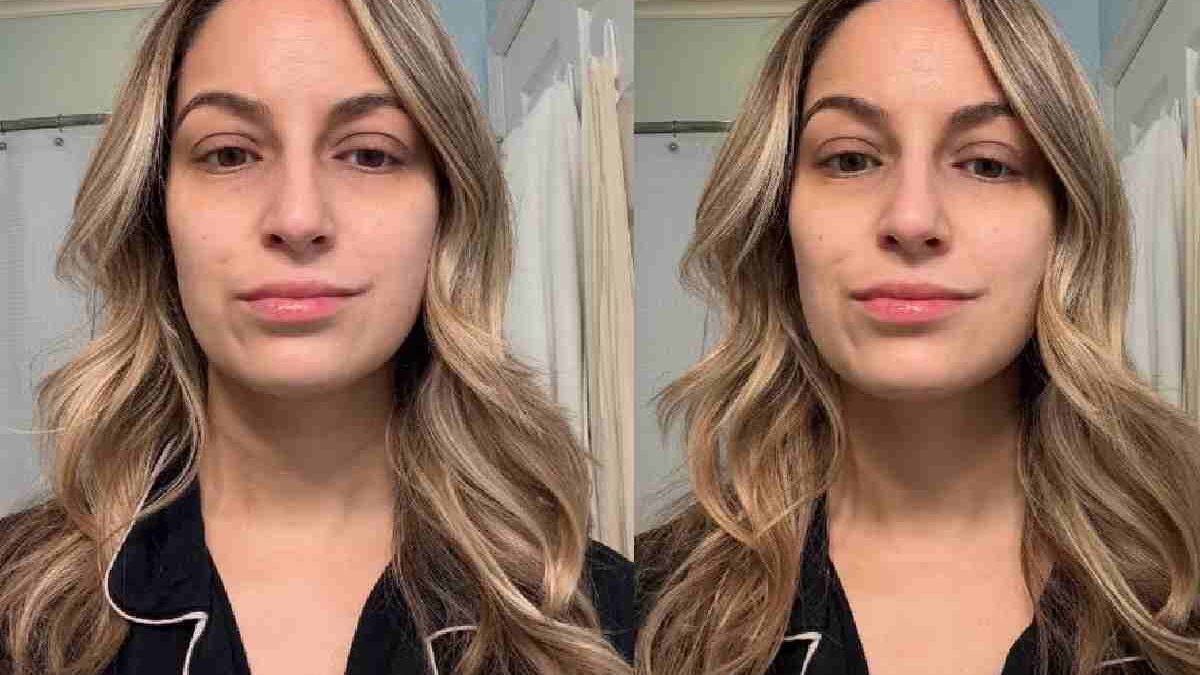 Best Eye Cream For Wrinkles You should Know
