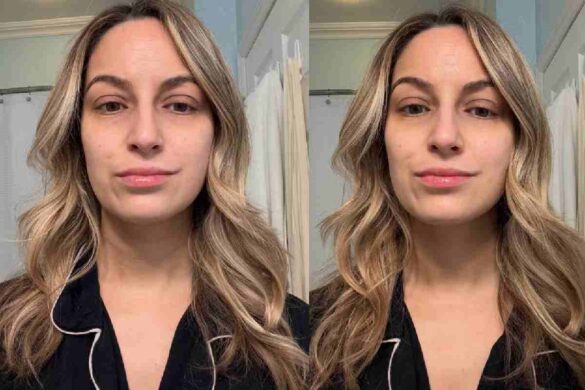 Best Eye Cream For Wrinkles You should Know